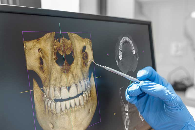 3D Cone Beam CT imaging