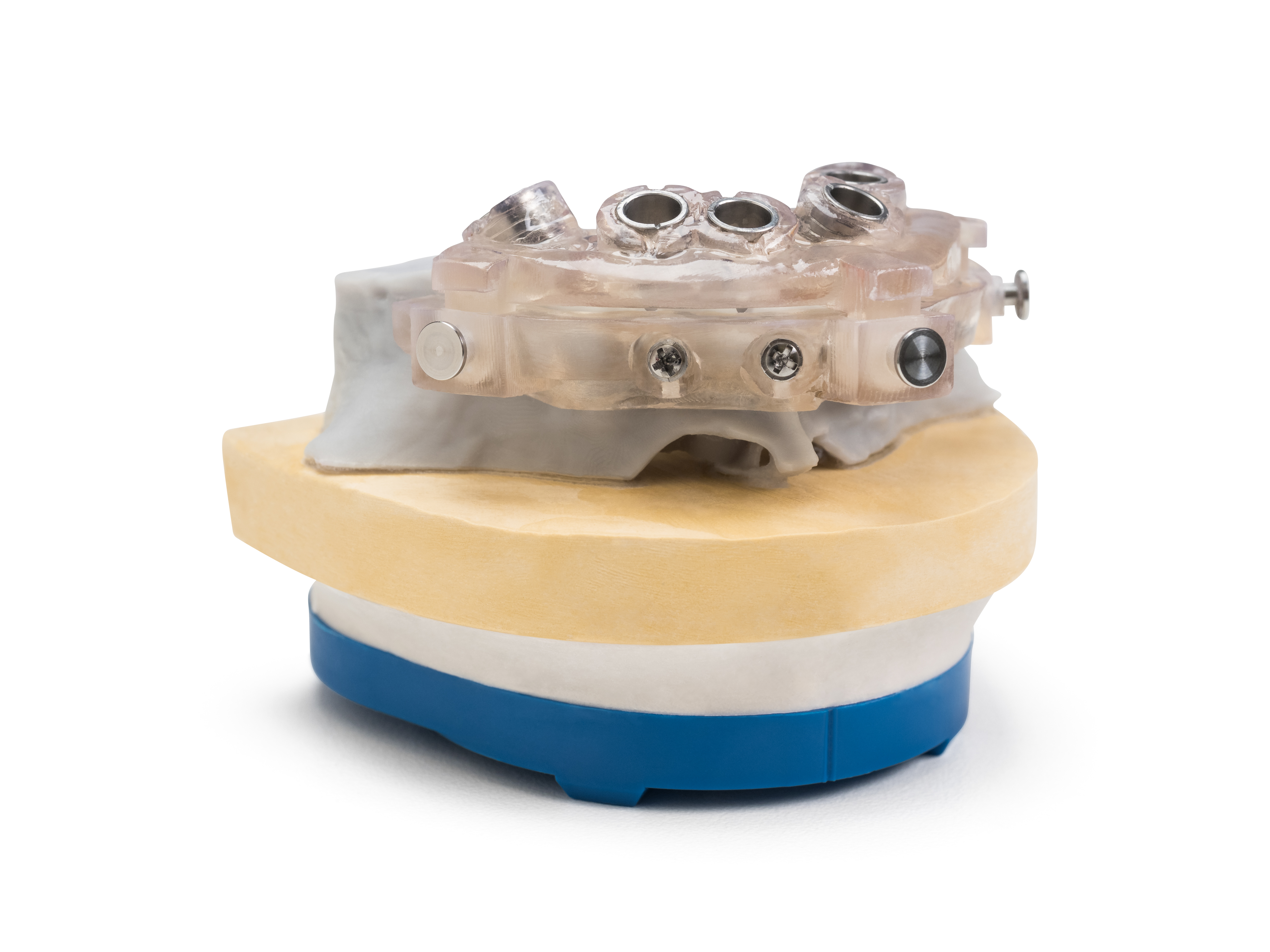 Guided implant surgery surgical guide